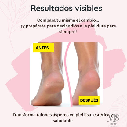 Removedor Callos Durezas Recargable