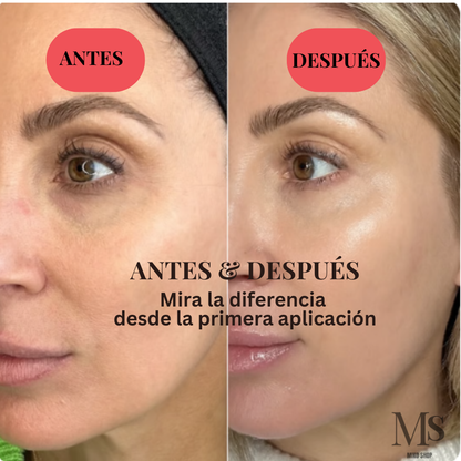 Parches Hidrogel con Extracto de Caracol (60 und)